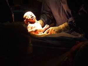 hypnobirthing australia hypnosis hypnotherapy childbirth caesarean c-section cesarean caesarian