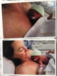 Stacey having skin to skin with her premature baby girl