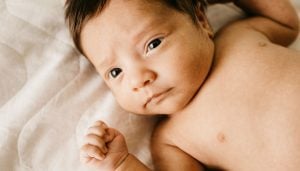 surgery for tongue tie 