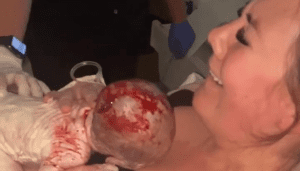 Induction vaginal birth