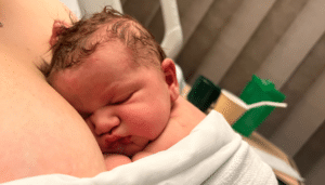 positive caesarean birth