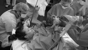 positive caesarean birth