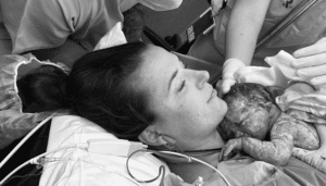 positive caesarean birth