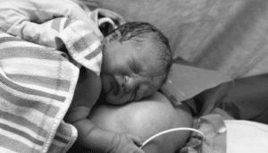caesarean birth